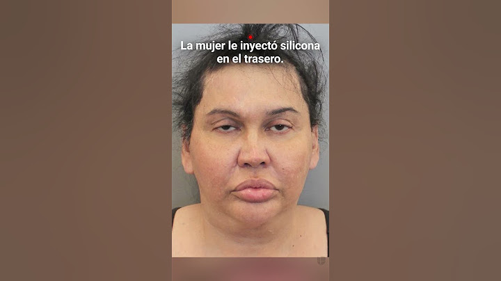 Sentencian a una mujer a 8 años de prisión por mal procedimiento estético #shorts