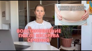 Как сделать живот плоским после кесарева сечения