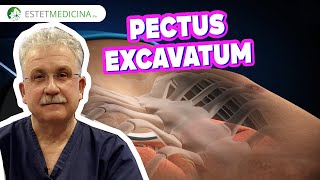 Воронкообразная деформация грудной клетки. ОПЕРАЦИЯ НАССА ⭕  PECTUS EXCAVATUM. др. Разумовский А.Ю.