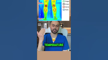 Do Not Ignore Poor Blood Flow In Your Feet⚠️ #health #medical #viral