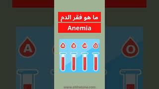 فقر الدم - Anemia