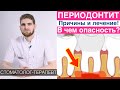 Периодонтит - симптомы, причины, последствия, лечение периодонтита. Профилактика и диагностика