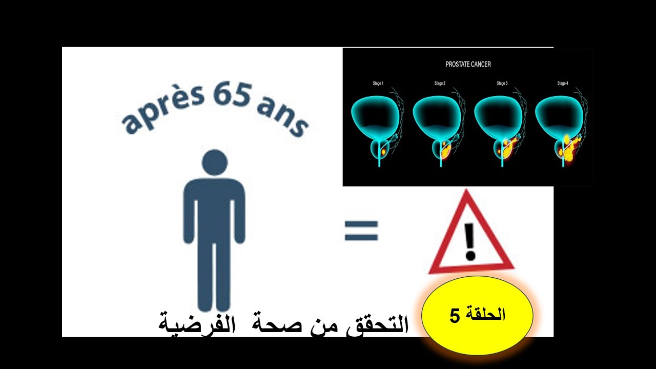 علوم طبيعية حل تمرين  سرطان البروستات الحلقة 5