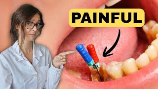Root Canals Don’t Hurt — But Yours Might