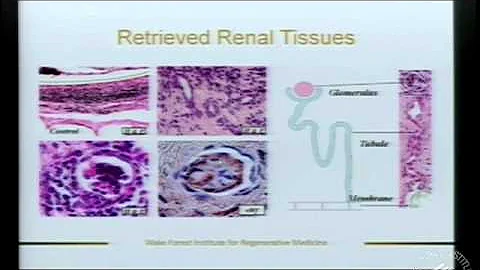 Regenerative Medicine: Current Concepts and Changing Trends