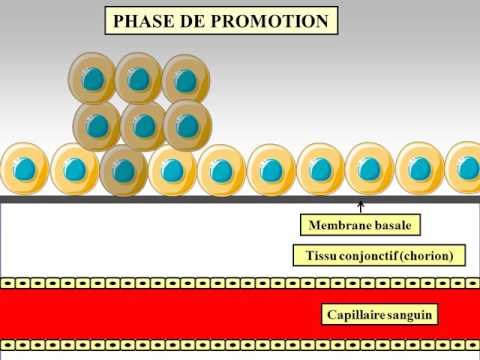 Vidéo: La Sensibilité Des Cellules Tumorales Au Vémurafénib Peut être Prédite à Partir De L'expression Des Protéines Dans Un Cadre D'essai De Panier BRAF-V600E