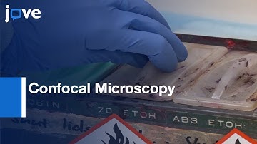 Confocal Microscopy for Visualizing METs | Protocol Preview