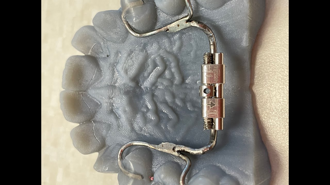 Simple Expander Expander Instructions - YouTube