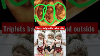 Triplets baby inside and outside trimester foryou cutebaby Triplets shorts  uttamup60