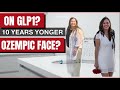 🌟 Took GLP-1 1 YR and Look 10 Years Younger | Tirzepatide | Back Arm follow up