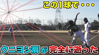 たった1球で肩が完全に逝った...治りかけの全力投球は絶対ダメ。