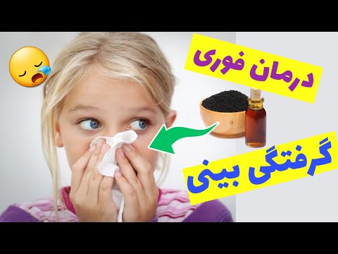 تصویری: چه زمانی صدای بینی نوزادان قطع می شود؟