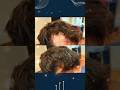 HRP Hair Restoration Transformation #hair #hairloss #haircare #hairlosstreatment #hairstyle #health