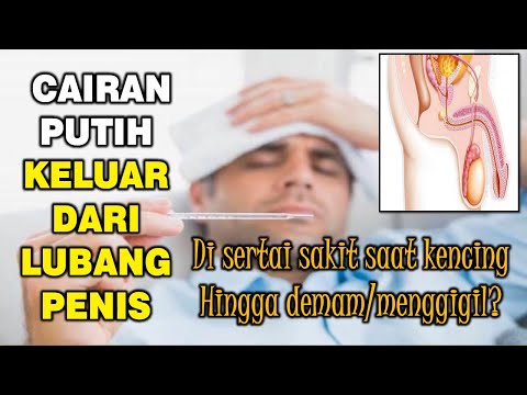 cairan-putih-keluar-dari-lubang-penis-|-sakit-saat-kencing-#kencingnanah