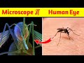 🔴 Mosquito under Microscope 🔥Microscope में मच्छर कुछ ऐसा दिखता है||fact 93