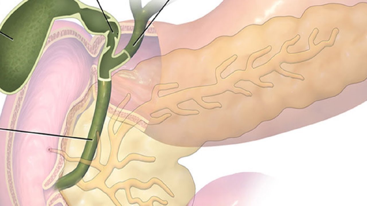 Желчный пузырь на лице. Билиарный сладж в желчном пузыре. Дисхолия поджелудочной. Дисхолия желчного пузыря что это такое.