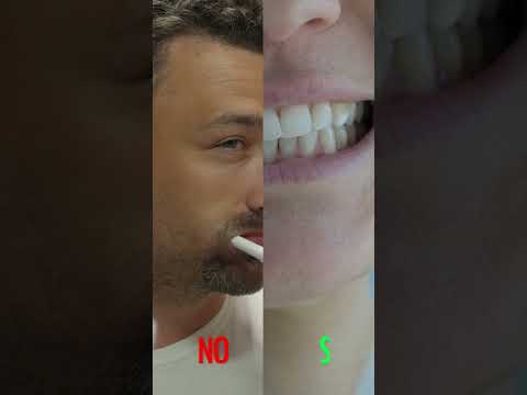 Video: Lo spazzolino sonico può danneggiare i denti?