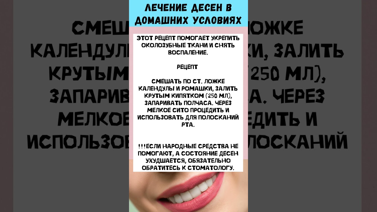 КРОВОТОЧАТ ДЕСНЫ? | УКРЕПЛЯЕМ ДЕСНЫ | НАРОДНОЕ СРЕДСТВО