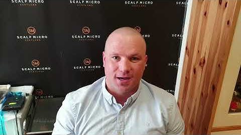 Brandon Shares His Scalp Micropigmentation Journey With Scalp Micro Scotland