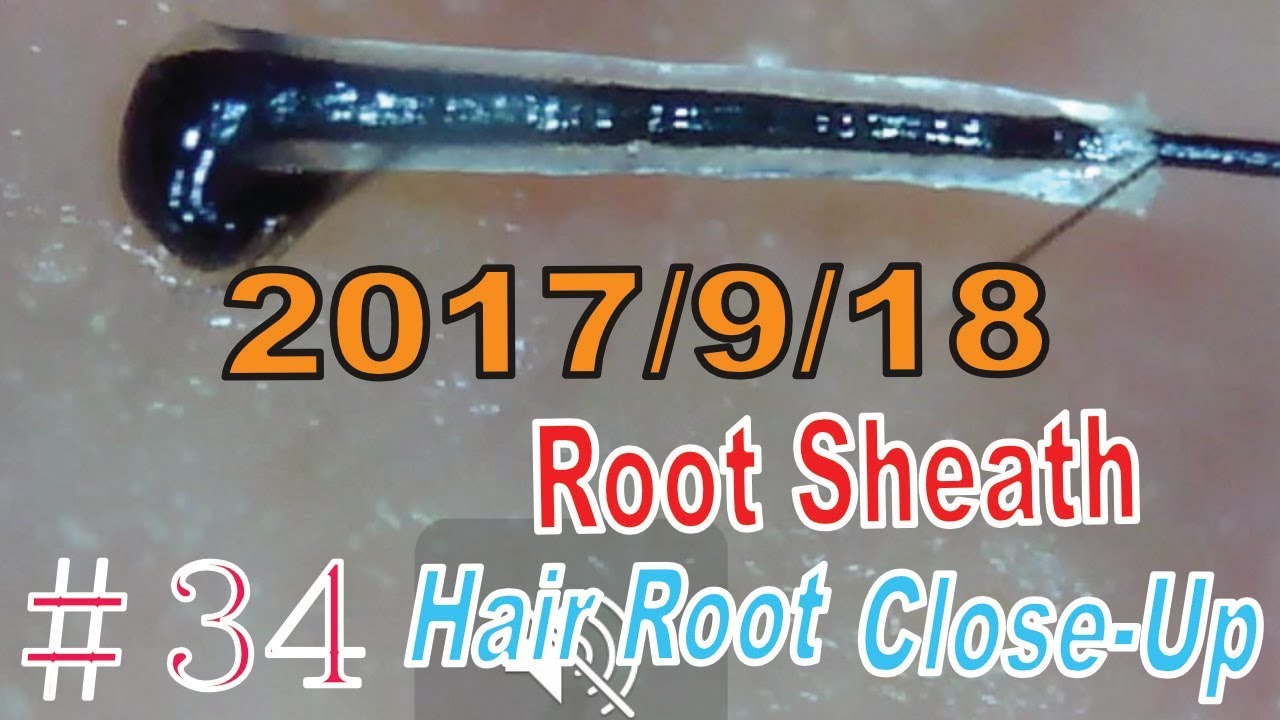 Plucked Hair Root Sheath