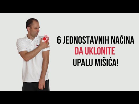 Video: 3 načina da se riješite uraslih noktiju na nogama