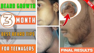 BEARD GROWTH || Best beard growth tips  for teenagers || 3 three month final beard results