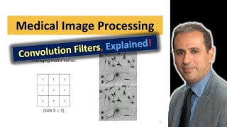 Image Processing #003 - Medical Images Enhancement via Smoothing - Convolution Filters
