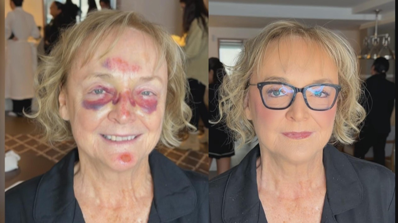 Makeup Artist Comes To Rescue After Mother Of Bride Falls Before Wedding