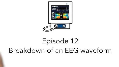 Bispectral Index™ Byte 12: Breakdown of an EEG Waveform