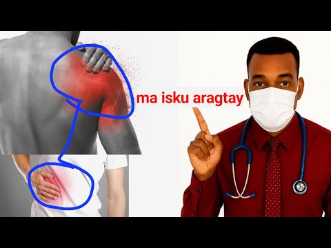 Garba Xanuunka Bog Xanuunka Lalabada Dhagaxa Xameetida Gallstones With Dr Timajilac