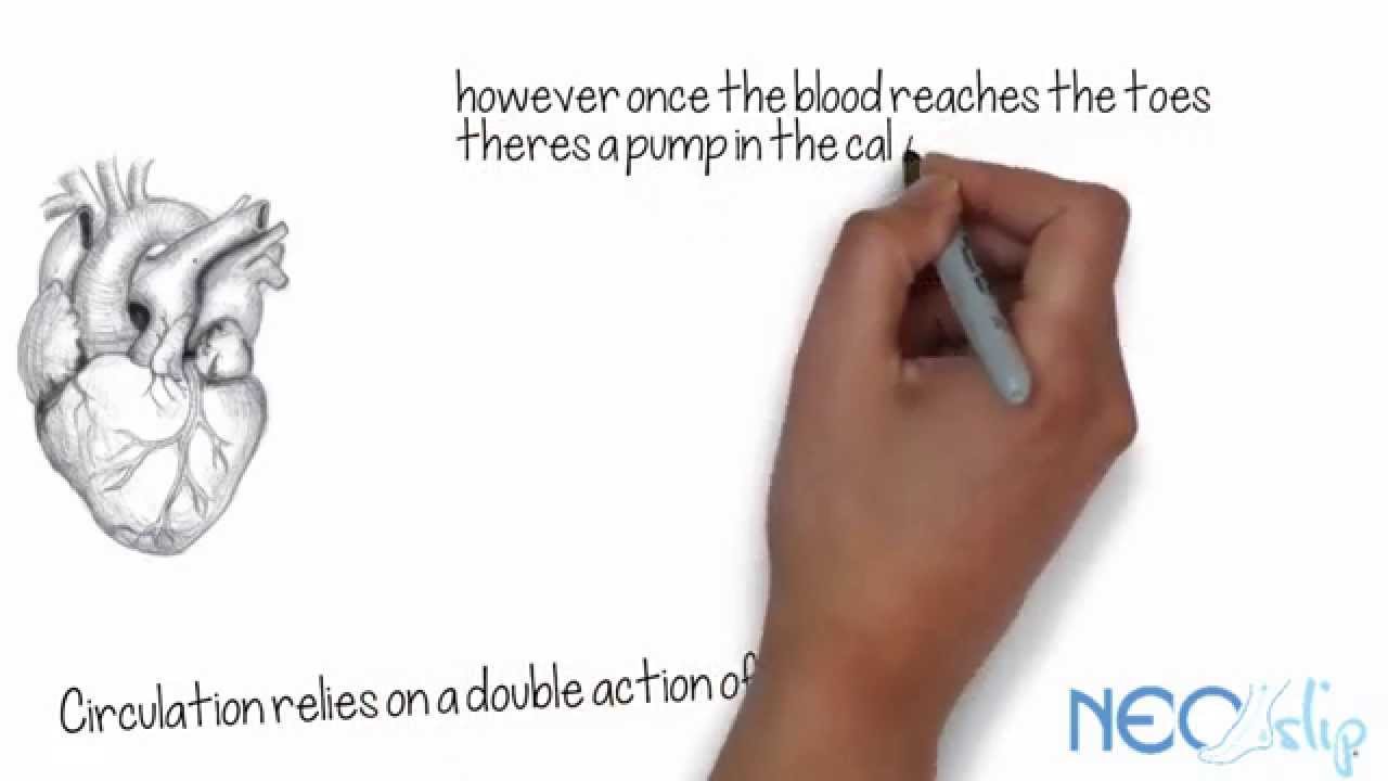 Dvt Stocks Operations How Stockings prevent DVT after an operation - YouTube