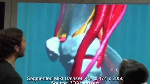 Medical data visualization system exploiting a light field display