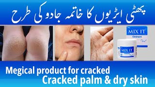 “Dry Skin? Cracks Gone! 💯 | Mix It Healing Ointment” #mixitointment #crackedskin #medicalskincare  screenshot 1