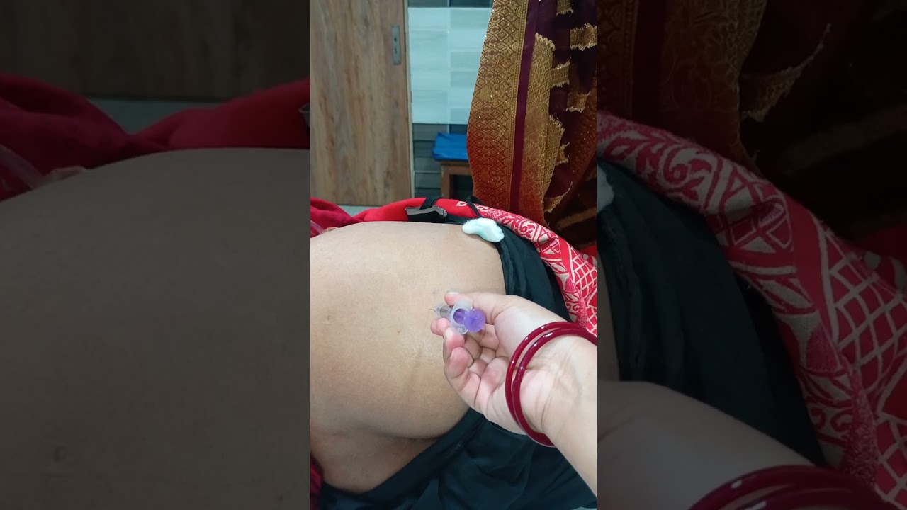 Im injection 