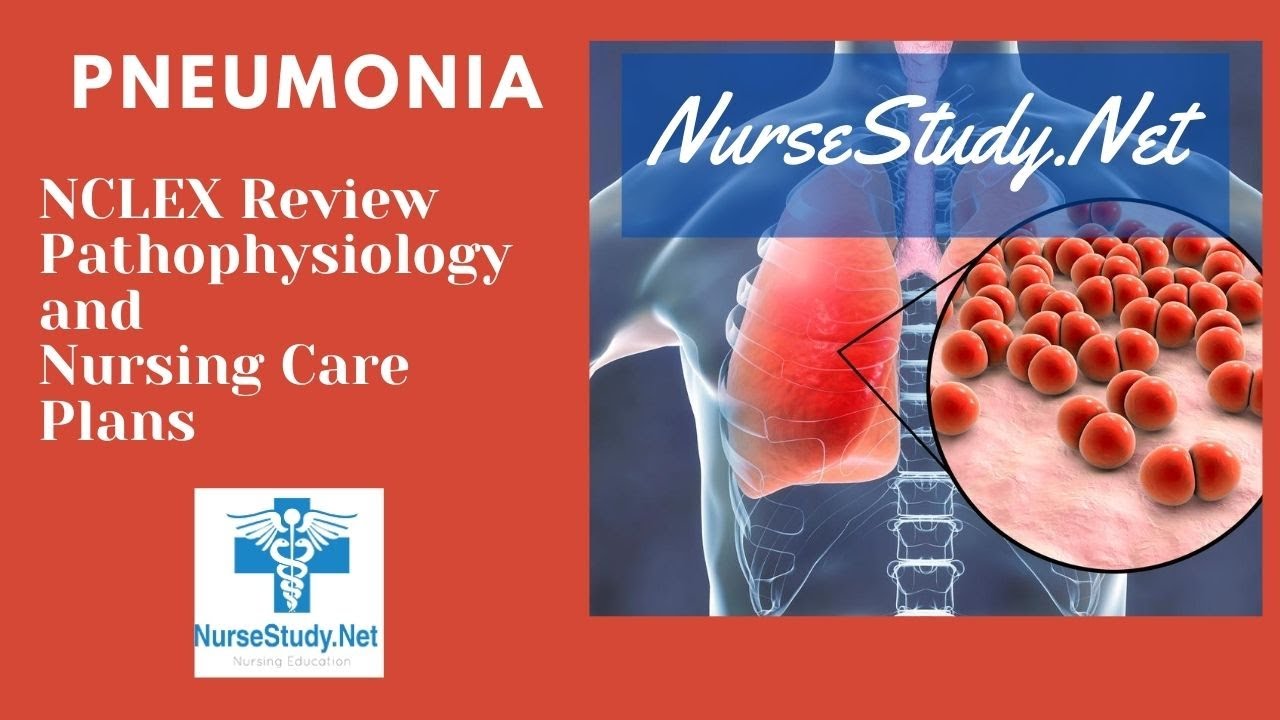 case study pneumonia nursing