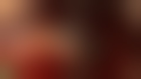 Sinus elevation using DASK