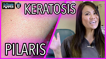 What Are These Bumps On My Skin? | Keratosis Pilaris | with Dr. Sandra Lee