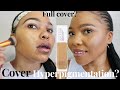 MAYBELLINE SUPERSTAY  24 HOUR FULL COVERAGE FOUNDATION REVIEW ON HYPERPIGMENTATION & MESLASMA