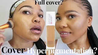 MAYBELLINE SUPERSTAY  24 HOUR FULL COVERAGE FOUNDATION REVIEW ON HYPERPIGMENTATION &amp; MELASMA