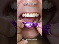 Most Satisfying Candy &amp; Chocolate ASMR 🍫🍬 #DoctorTristanPeh #ASMR