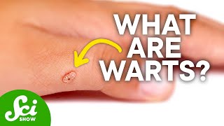 Do Toads Actually Give You Warts? | The Truth About Warts & How to Get Rid of Them