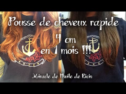 Soin N 3 4 Cm En 1 Mois La Pousse De Cheveux Rapide Grace A L