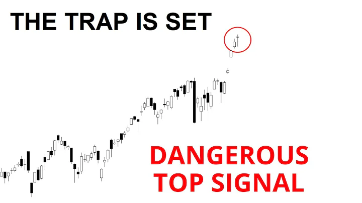 Technical Analysis of Stocks: SPY / QQQ / NVDA / TSLA / AMD / PLTR / UNH / SOFI