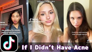 If Only I Didn&#39;t Have Acne | TikTok Compilation