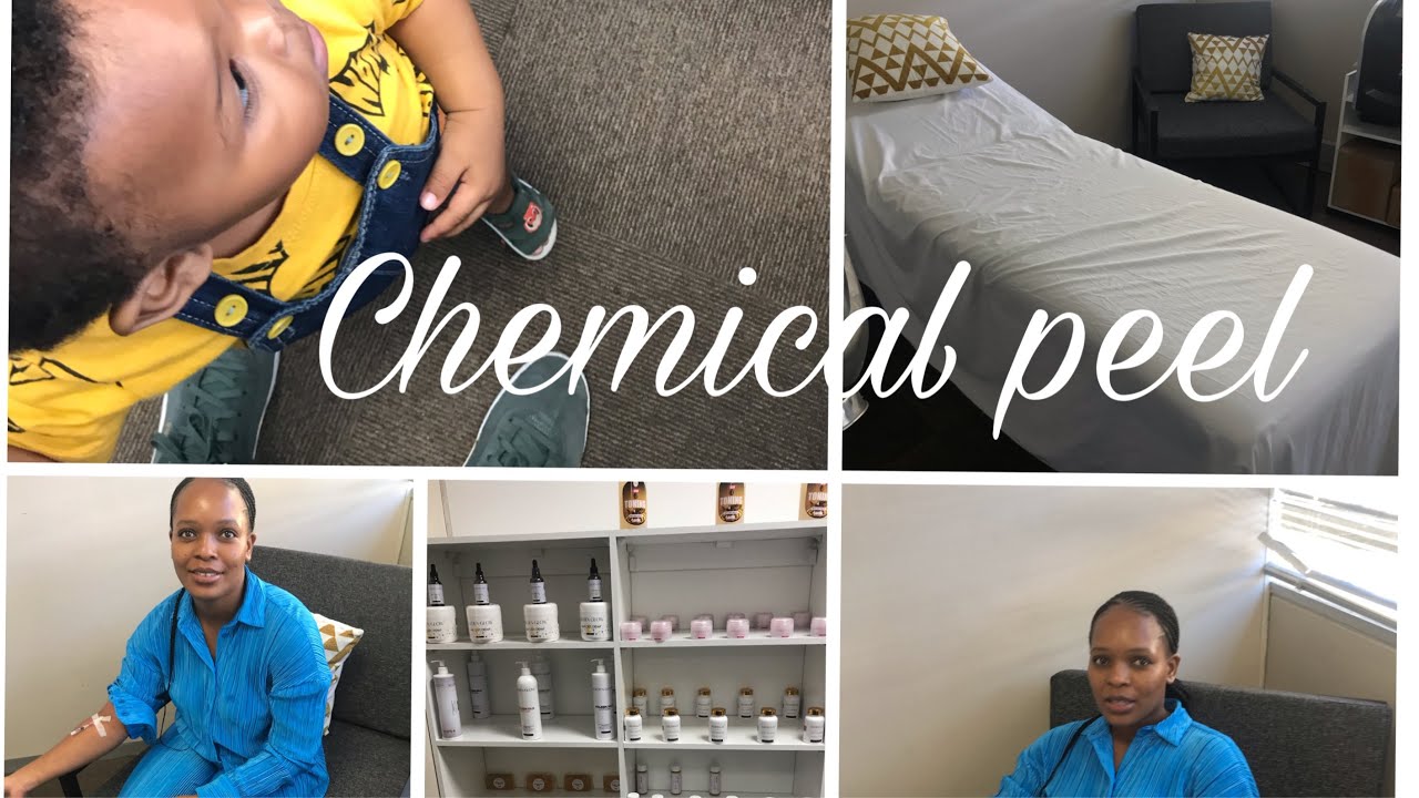 Chemical peel | Second session