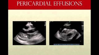 Focused Cardiac Ultrasound Case Based MS3 Video