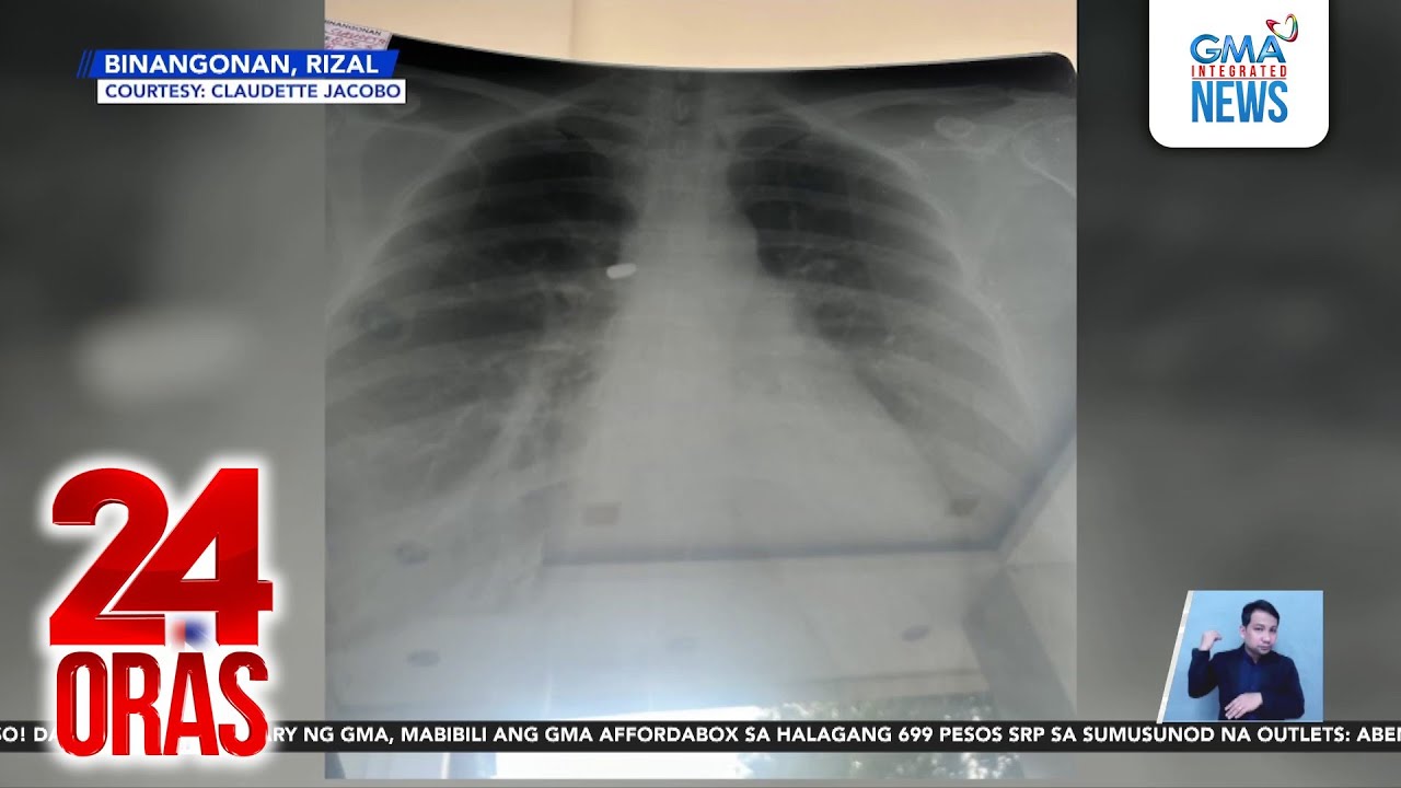 Pasahero ng jeepney, tinamaan ng ligaw na bala | 24 Oras