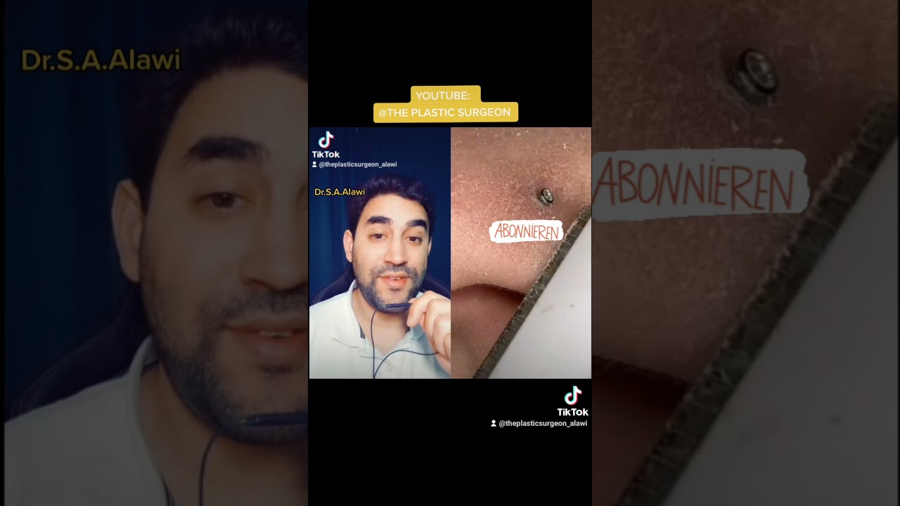 Die richtige Hautpflege bei trockener Haut 