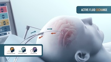 A New Approach to Intracranial Bleeding - IRRAflow by Life Science Animation