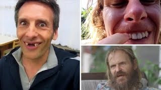 Veganism: The Rotten Teeth Diet! Running Raw, Unnatural Vegan, Light Twins and others